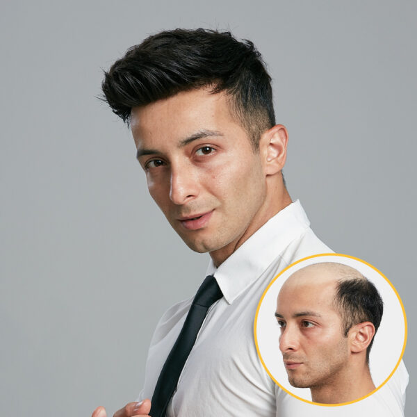 D7-5 French Lace Hair System with NPU (8)